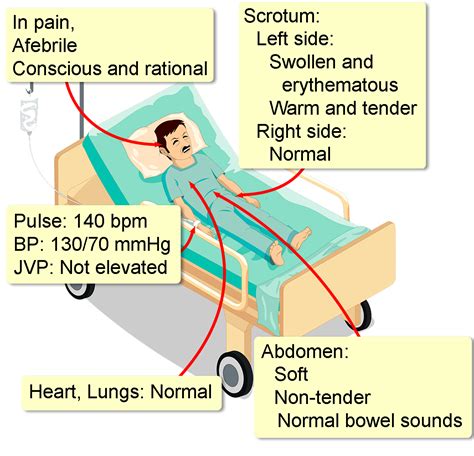 urine test for testicular torsion